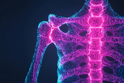 Osteoporosi: la ladra silenziosa di ossa