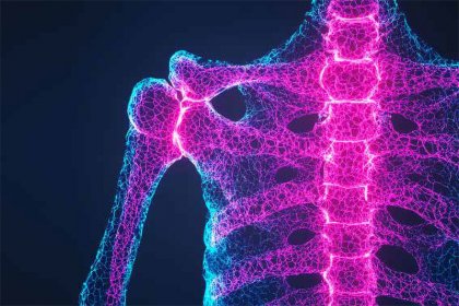 Osteoporosi: la ladra silenziosa di ossa